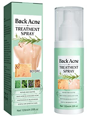 HASAIKA® Rücken Akne Spray, Rücken-Peeling Tiefenreinigung, Akne-Behandlungsspray für Körper, Brust und Rücken, sanft zur Haut, 120 ml