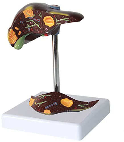 Anatomisches Modell der menschlichen Leber, lebensgroßes anatomisches Modell der Leber, Simulationsmodell der hepatobiliären Verdauungsorgane, Anatomiemodell menschlicher Organe als Medizin