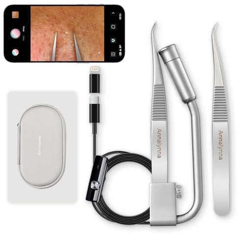Luma 1 Visuelle Mitesser-Entferner-Pinzette mit Kamera – Pickelpinzette mit 20-facher Vergrößerung, 1080P, 8 LED-Lichtern, 2× Pinzetten im Delfin-Design aus nicht magnetischem Edelstahl, Porenreiniger