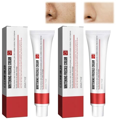 2PCS Crema Sbiancante Per Lentiggini, Rimozione Delle Macchie Scure Da Melasma, CremA Schiarente Macchie Viso, Crema Per La Rimozione Delle Cicatrici Da Acne,20g