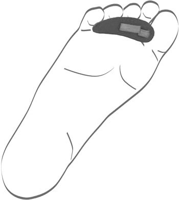 Berkemann Zehenkissen rechts 50008154002651 Schuhpads