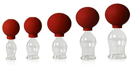 Lauschaer Glas 5er Schröpfglas-Set mit Ball 20-25-30-35-40mm zum professionellen, medizinischen,feuerlosen Schröpfen mundgeblasen, handgeformt, Schröpfglas, Schröpfgläser