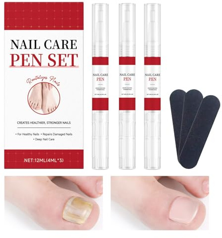 Rinforzante per Unghie 3 Pezzi Penna per Riparazione Unghie | Soluzione Per Riparare Unghie Dei Piedi Danneggiate Ideale per Casa, Viaggio, Manicure, Pedicure, Salon, Adulti, Donne,