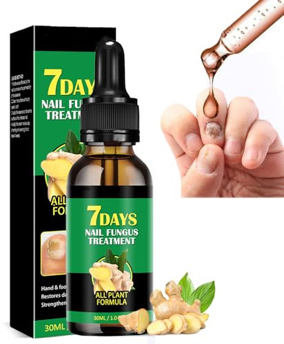 Ginger Fungal Nail Treatment, 7 Days Ginger Nail Treatment, Nail Fungus Treatment for Toenail and Fingernail, Ginger Nail Growth Serum, Multi-Purpose Nail Repair for Your nails a Natural Shine