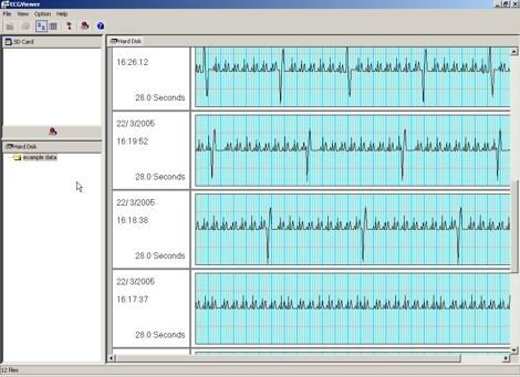 Omron Heart Scan Expansion Pack Software (Without ECG Monitor, Juste Le Programme)