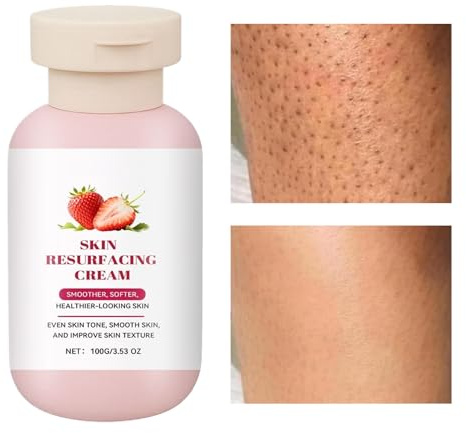 Crema Idratante Corpo | Crema Idratante Ristrutturante 100g Gambe - Trattamento Levigante per Pelli Sensibili Grasse Mature | Utilizzo Notte Mattina Doccia Viaggio