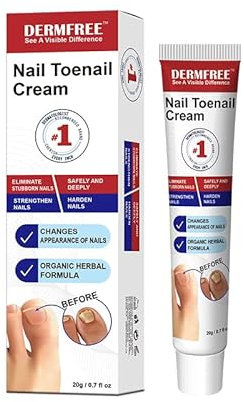 Mycose Ongles Des Pieds Crème 20g