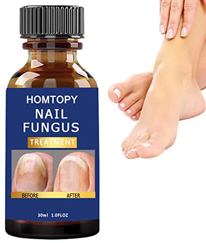 SHRIGM Durcisseur et fortifiant pour Ongles | Mycoses Solution Extra Forte pour Les Ongles - Patchs pour Ongles Anti-fongiques pour Le renouvellement des Ongles Force maximale pour Les