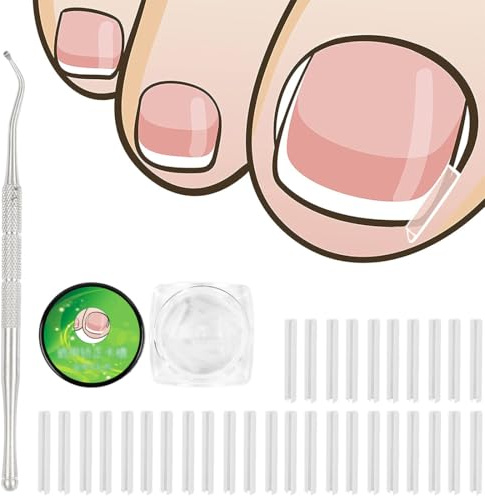 50 pezzi Set correttore per unghie incarnite, Strisce raddrizzanti per unghie incarnite senza dolore con sollevatore per unghie, Kit di strumenti per unghie incarnite facili da usare