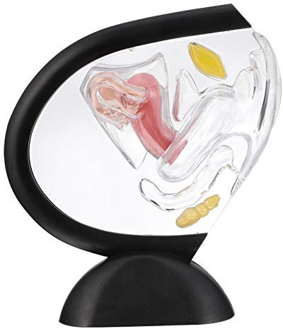 Transparentes Uterus-modell Uterus Pädagogisches Werkzeug Pathologisches Uterusmodell Weibliches Geschlechtsteil Pvc Unterrichtsmaterialien Menschlicher Körper