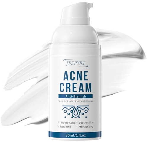 Acne Cream: Acne Care Spot Cream Acne Pimples Recurrent Breakouts Face Care Suitable for all skin types Post-acne Scar Repair 30ml / 1fl oz