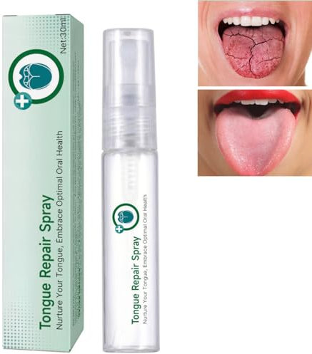 Tongue Repair Spray,Instant Dry Mouth Relief,Fissured Tongue Relief Spray,Sore Tongue Re/LIEF Mint Breath S/Pray,Breath Freshener for Dryness& Bad Brea/th