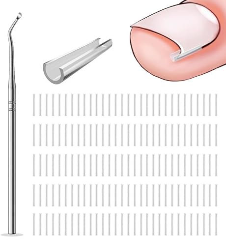 150 Stück Nagelspange Fußnägel,Eingewachsene Zehennagel Korrektur,Nagelfüller zur Korrektur von Zehennagel Eingewachsen,Korrigierende Pediküre-Werkzeuge für Die Fußpflege
