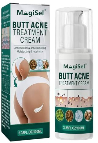 Creme zur Entfernung von Mitessern am Gesäß, Arschcreme, Akne-Entferner Am Gesäß, Creme zur Entfernung von Mitessern Am Gesäß,Akne-Gluteus-Behandlung,Creme zur Behandlung von Gluteekorn, 100ml