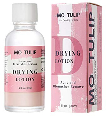 MO TULIP Acne Drying Lotion, Overnight Acne Acid and Acne Spot Treatment for Face and Body, Pimple Lotion Spot Treatment, Dry Out Pimples, Blemishes, and Clean pores (1OZ)
