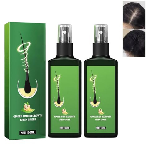 Grgowe 2 st ingefära hårväxt spray, närande ingefära spray, Growthplus närande ingefära spray, för behandling av håravfall