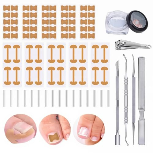 16pcs Kit Strumenti Correzione Unghia Incarnita Medico Professionale Acciaio Inox,kit manicure,pedicure,unghie