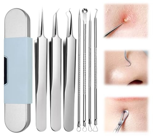 Mitesserentferner Komedonenquetscher Set, 2026 Neu Pickel Ausdrücken Werkzeug mit Gehäuse, Gesichtsreinigung Remover Tool Kit für Whitehead Akne auf der Nase Gesicht Hautunreinheiten (7Pcs)