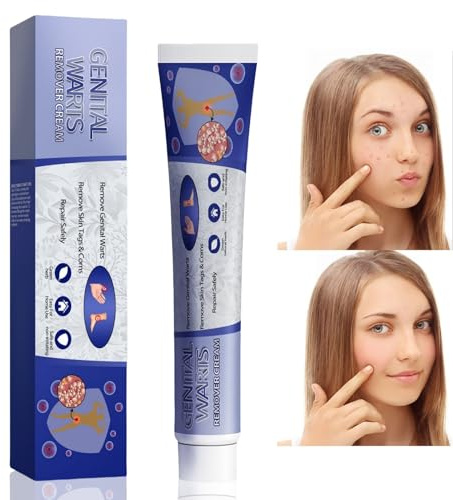 Skin Wart Remover for Skin and Face,Skin Tag Remover-Removal Cream,Fast-Acting Tag Remover Skin,Natural Wart Remover Cream for Hands and Foot,Skin Wart Treatment,Suitable for Both Men and Women