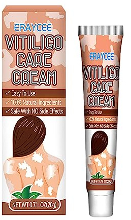 Crema vitiligine,Crema vitiligine contro macchie bianche sulla pelle 20 g – Crema facile da applicare contro le macchie bianche sulla pelle Migliora i melanociti epidermici, riduce la pologmasi bianca