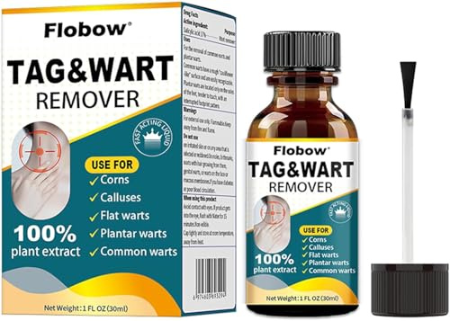 Kit para eliminar verrugas 30ml, lunares y callosidades, líquido para eliminar lunares y verrugas en cuerpo y manos