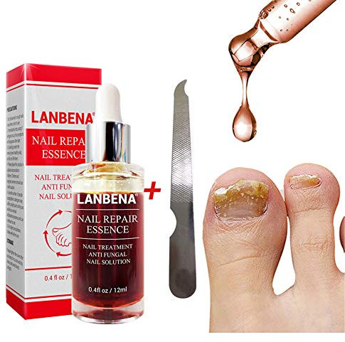 Beito 1PC Nail Repairs Solution de renouvellement des ongles à l'huile essentielle tue les ongles fongiques Traitement fongique pour ongles cassants et craquelés (12ML)