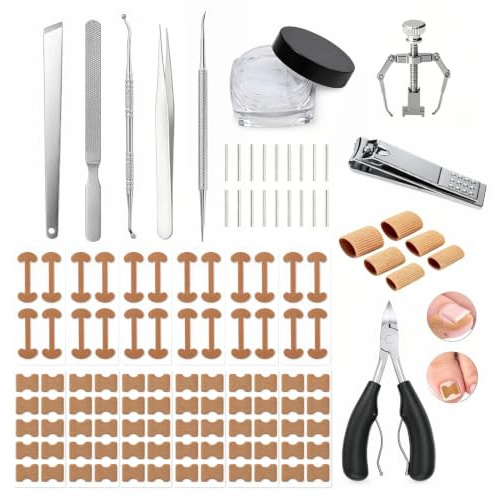 Culinavog 128 Pezzi Set Correzione Unghie Incarnite Professionale