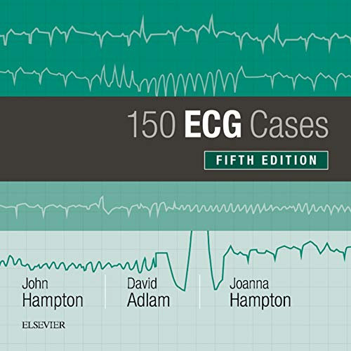 150 ECG Cases (English Edition)