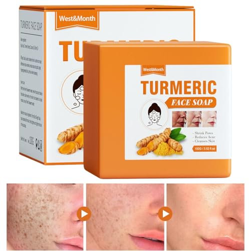 Kurkuma-Seife, handgemachtes Stück für Gesicht und Körper, natürliches Kurkuma-Seifenstück, reinigt Poren, Akne-Entferner, spendet Feuchtigkeit und reinigt die Haut, für alle Hauttypen