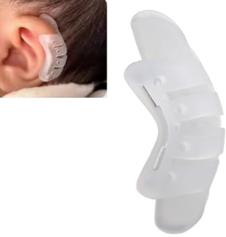 KKPLZZ Correttori per Orecchie Neonato, Patch per Correzione Valgo dell'Auricolare per Correttori Estetici per Orecchie Protrudenti Adesivi per Orecchie Protrudenti
