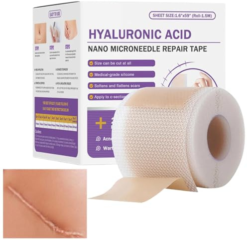Bande En Silicone À L'acide Hyaluronique,Ruban En Silicone Pour Cicatrices,parfait Pour Les Cicatrices Postopératoires,pour Cicatrice Et Rides, Doux Pour La Peau,convient À Les Types De Peau 4x150cm