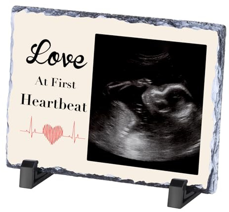 Individueller Sonogramm-Bilderrahmen, personalisierbar, Ultraschall-Bilderrahmen für Schwangerschaftsankündigung, Baby-Andenkenrahmen, Babyparty, individuelle Schwangerschaftsgeschenke für werdende
