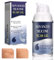 30g Gel Cicatrices,Gel éliminatrice De Cicatrices,l'élimination cicatrices pour Le Visage et Le Corps,Gelhydratant pour cicatrices chirurgicales,Absorption Rapide,réduit visible cicatrices