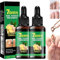 2Pcs Fungal Nail Treatment, 7 Days Nail Fungus Treatment, Ginger Nail Treatment for Toenail and Fingernail, Ginger Fungal Nail Repair Serum for Thin, Broken, Discolored Nails