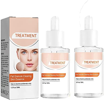 Oveallgo Milia - Esencia limpiadora, 30 ml, tratamiento de eliminación de manchas Milia, aceite esencial para ojos, tratamiento de manchas Milia, esencia de ojeras, suero facial (2 unidades)