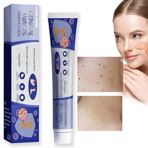 Skin Tag Remover Cream,Skin Wart Remover for Skin and Face,Skin Wart Treatment,Tags and Mole Remover Cream for Body,Natural Wart Remover Cream for Hands and Foot,Fast-Acting Tag Remover Skin1
