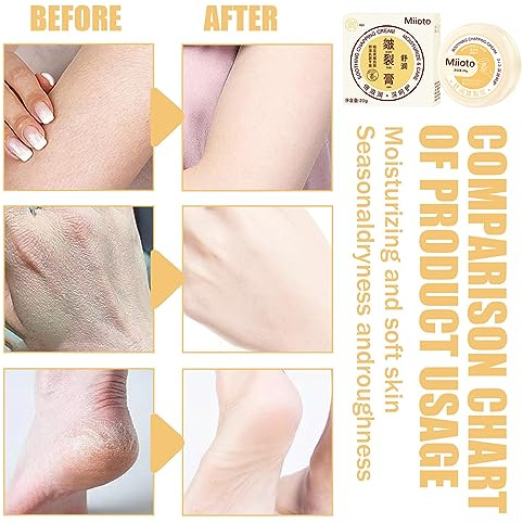 Cracked Heet Treatment Balm, Fersenrisse Trockenrisse Reparaturcreme, Rissige Haut Reparatur Creme, Cracked Skin Repair Foot Cream, Anti Cracking Hand und Fußcreme