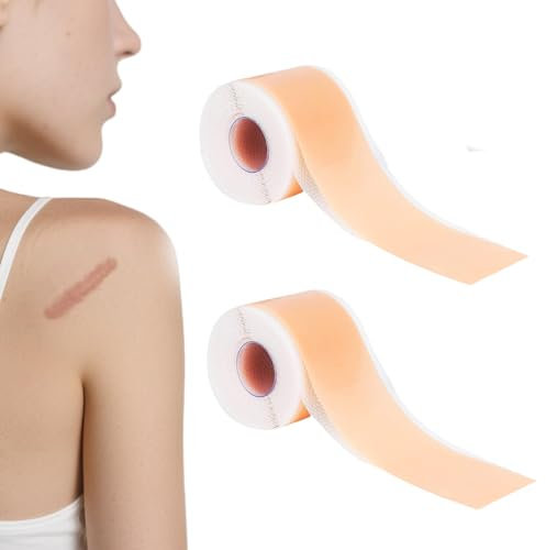 Pansements anti-cicatrices en silicone médical, excellente adhérence, pansements en silicone doux pour la peau pour les interventions chirurgicales, les cicatrices d'acné, les cicatrices d'acné, les