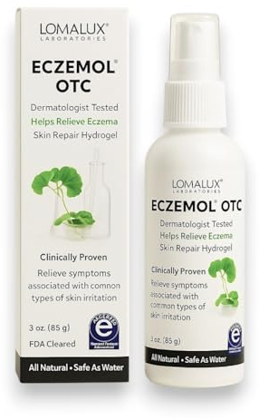 Loma Lux New Eczemol OTC Spray Natural & No Sting Hypochlorous for Eczema, Wounds, Burns, Cuts, Skin Irritation, Radiation Dermatitis, Sunburn, Itchy Skin, for Kids & Adults