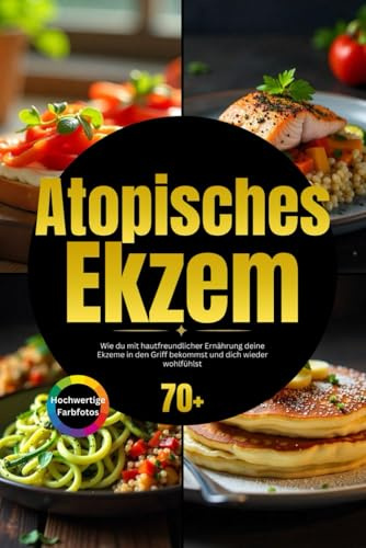 Atopisches Ekzem Buch: Wie du mit hautfreundlicher Ernährung deine Ekzeme in den Griff bekommst und dich wieder wohlfühlst inkl. Gesundheitstipps