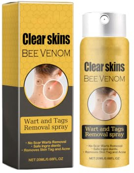 Spray de Veneno De Abeja,Skin Tag Remover Spray,Sprays de Cuidado Des La Piel Veneno Abeja,Sprays Eliminación De Verrugas,Para Todos Los Tipos Del Piel