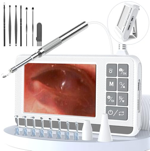 VITCOCO Otoscopio Removedor de Cera, Limpiador de Oidos Cera de 3,9mm con Pantalla Hd IPS 4,3 Pulgadas, Limpiador Oidos Adultos Ultra Delgado, Cuchara Visual Inteligente para Extracción de Oídos