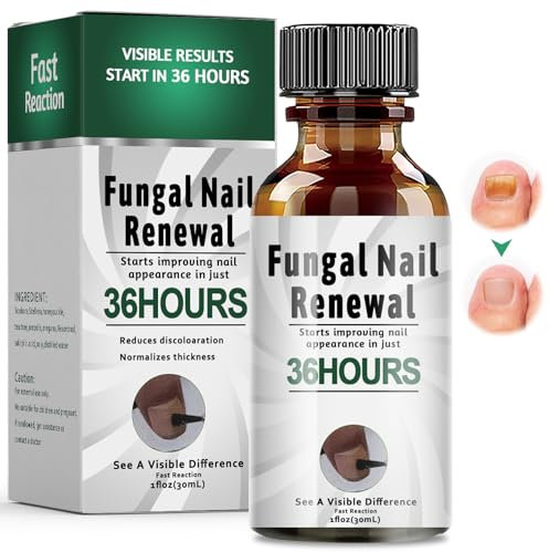 30ml Nagelpflege Behandlung, Nail Repair, Schutz Stärkung brüchiger Nägel, Fingernägel und Fußnägel für Nail Care, Schnell Wirkendes Nagelpflege Pflegend