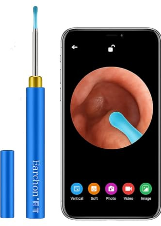 Pulitore per orecchie WiFi Earchon 1080P, Otoscopio impermeabile con fotocamera a 360°, Endoscopio auricolare con applicazione per iPhone, Android. Per adulti, bambini e animali domestici.