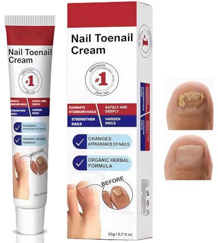 20g Nagelpflege Creme, Nagelreparaturcreme, Nagelpflege für Fußnägel, Schutz & Stärkung Brüchiger Nägel, Fußnägel Behandlung für Gebrochene und Verfärbte Nägel, mit Nagelfeilen und Wattestäbchen