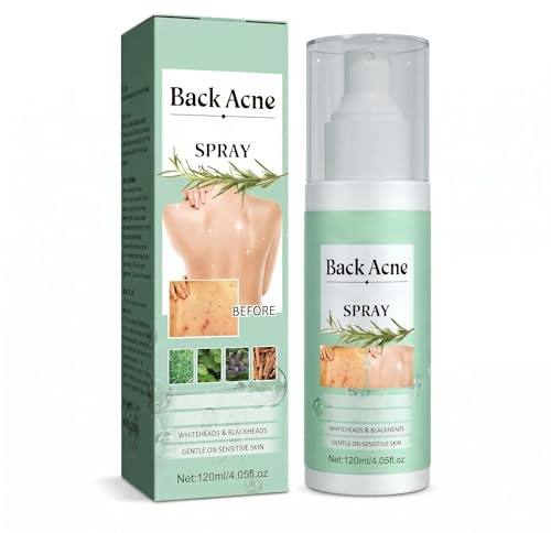 Spray de traitement de l'acné du dos, Exfoliant pour le dos, nettoyage en profondeur pour javascript, le corps, la poitrine et le dos, effet nettoyant doux sans sécheresse, 120 ml