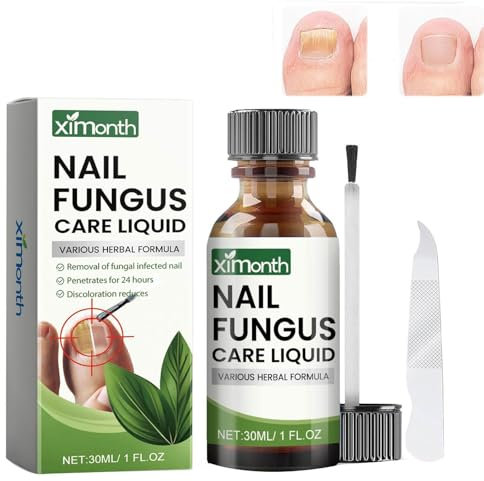 Tratamiento de hongos en las uñas de los pies, extra fuerte, tratamiento de uñas, tratamiento de hongos en las uñas de los pies y las uñas, protege uñas gruesas, rotas y decoloradas, 30 ml