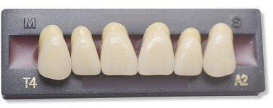 Dents Artificielles - INCISIVE DU HAUT (6 dents)