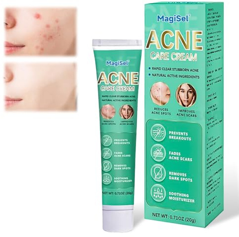 Crema Para El Acné, Acnes Cream, Crema Antiacne, 20g, Pomada facial antiacné, Cream para el cuidado facial, Humectación Duradera,Sin Resequedad,Eliminar El Acné Para Pieles Propensas A Las Espinillas