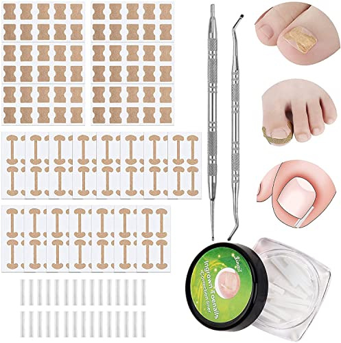 Set di 150 + 2 Strumenti per Unghie dei Piedi Incarniti, Includi, Patch Unghie Elastico Adesivi Curvi delle Unghie File dell'Unghia Incarnito e Adesivi Correzione dell'Unghia Piede Incarniti